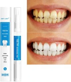 BOR Tanden Bleekpen - Tanden Bleken - Tandenbleekset - Whitening Pen - Tandenblekers - Wittere Tanden - Teeth Whitening Pen - Tanden Bleker 11 BOR Tanden Bleekpen - Tanden Bleken - Tandenbleekset - Whitening Pen - Tandenblekers - Wittere Tanden - Teeth Whitening Pen - Tanden Bleker -Verzorgingsproducten 1031x1200 3