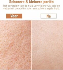 Fesio Lichaamsborstel Met Lange Steel - Dubbelzijdig - Dry Brushing Rugborstel/Badborstel/Doucheborstel/Huidborstel - 43 Cm -Verzorgingsproducten 1080x1200 1