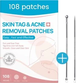 Acne Patches (108x) Met Blackhead Remover Set - Puisten Pleister - Puisten Verwijderaar - 108 Pleisters In 2 Formaten - Mee Eters Verwijderen - Pimple Patch Voor Acneverzorging Met Comedonenlepel Set - Acne Stickers