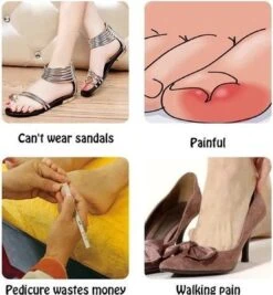 Merkloos Ingegroeide Teennagel Corrector -Verzorgingsproducten 1111x1200