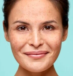 Biodermal Vette & Gemengde Huid Face Gel - 150ml – Bij Overtollig Talg, Puistjes En Onzuiverheden 16 Biodermal Vette & Gemengde Huid Face Gel - 150ml – Bij Overtollig Talg, Puistjes En Onzuiverheden -Verzorgingsproducten 1154x1200 7