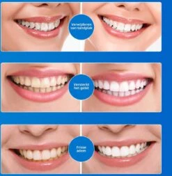 B-care Tanden Bleekpen - Teeth Whitening Pen - Tanden Bleker - Wittere Tanden - Teeth Whitening Strips - Professioneel Resultaat - Tandsteen Verwijderaar - Zonder Peroxide - Tandenbleekset - Tanden Bleken 20 B-care Tanden Bleekpen - Teeth Whitening Pen - Tanden Bleker - Wittere Tanden - Teeth Whitening Strips - Professioneel Resultaat - Tandsteen Verwijderaar - Zonder Peroxide - Tandenbleekset - Tanden Bleken -Verzorgingsproducten 1170x1200 4