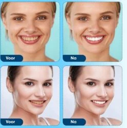 Diamond White - Teeth Whitening Strips - 28x Strips - Zonder Peroxide (0%) - Tandenbleekset - Tandenbleek Strips – Mint 17 Diamond White - Teeth Whitening Strips - 28x Strips - Zonder Peroxide (0%) - Tandenbleekset - Tandenbleek Strips – Mint -Verzorgingsproducten 1185x1200 7