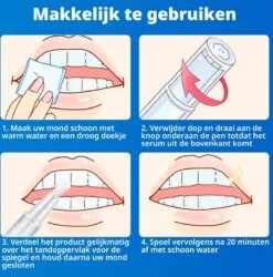 B-care Tanden Bleekpen - Teeth Whitening Pen - Tanden Bleker - Wittere Tanden - Teeth Whitening Strips - Professioneel Resultaat - Tandsteen Verwijderaar - Zonder Peroxide - Tandenbleekset - Tanden Bleken 16 B-care Tanden Bleekpen - Teeth Whitening Pen - Tanden Bleker - Wittere Tanden - Teeth Whitening Strips - Professioneel Resultaat - Tandsteen Verwijderaar - Zonder Peroxide - Tandenbleekset - Tanden Bleken -Verzorgingsproducten 1185x1200 8