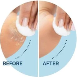 Scholl Velvet Smooth Voetvijl Wet & Dry - Starter - 1 Stuk 9 Scholl Velvet Smooth Voetvijl Wet & Dry - Starter - 1 Stuk -Verzorgingsproducten 1196x1200