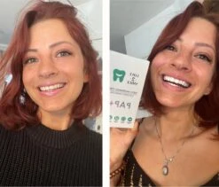 Love2smile PAP+ Premium Strips - Whitening Strips - De Natuurlijke Tandenbleker Van Nederland & België - Goedgekeurde Tandenbleek Strips - Teeth Whitening Strips - Wittere Tanden - Zonder Peroxide 11 Love2smile PAP+ Premium Strips - Whitening Strips - De Natuurlijke Tandenbleker Van Nederland & België - Goedgekeurde Tandenbleek Strips - Teeth Whitening Strips - Wittere Tanden - Zonder Peroxide -Verzorgingsproducten 1200x1023