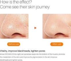 JTEX® - Professioneel LED Masker - Gezichtsmasker - Face Mask - Lichttherapie - 7 Soorten Behandelingen - Anti Rimpel - Anti Acne Huidverzorging - Skin Cleaner - Masker - Anti Aging Mask - Gezichtsbehandeling - New Generation - LED Masker -Verzorgingsproducten 1200x1035 4