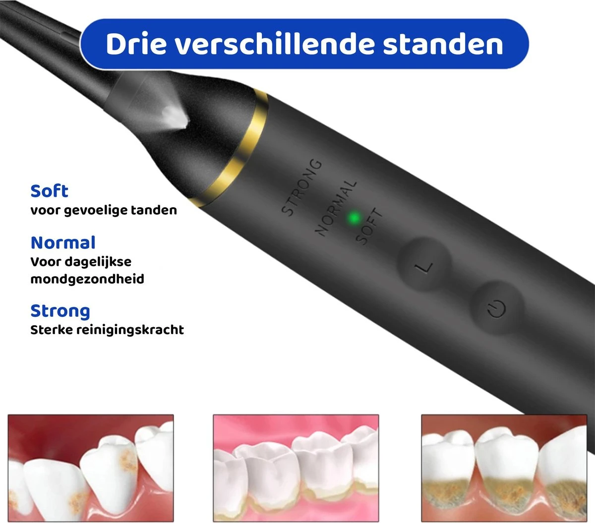 ExCorn Elektrische Tandsteen Verwijderaar - Inclusief 6-delig Tandartsset - 3 Standen - Elektrisch Tandplak Verwijderen - Tanden Polijsten 8 ExCorn Elektrische Tandsteen Verwijderaar - Inclusief 6-delig Tandartsset - 3 Standen - Elektrisch Tandplak Verwijderen - Tanden Polijsten - Afbeelding 6