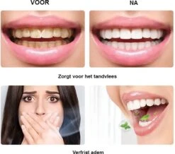 BOR Tanden Bleekpen - Tanden Bleken - Tandenbleekset - Whitening Pen - Tandenblekers - Wittere Tanden - Teeth Whitening Pen - Tanden Bleker 12 BOR Tanden Bleekpen - Tanden Bleken - Tandenbleekset - Whitening Pen - Tandenblekers - Wittere Tanden - Teeth Whitening Pen - Tanden Bleker -Verzorgingsproducten 1200x1061 3