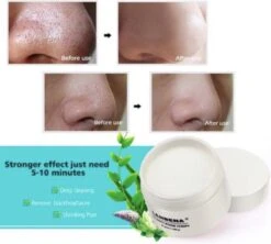 Lanbena Strips - Blackhead - Anti Mee-eters - Grove Poriën - Mee-eters Verwijderen - Acne - Huidverzorging 13 Lanbena Strips - Blackhead - Anti Mee-eters - Grove Poriën - Mee-eters Verwijderen - Acne - Huidverzorging -Verzorgingsproducten 1200x1080 4