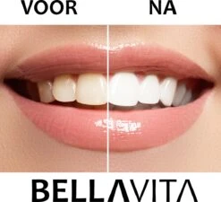 BELLAVITA Tandenbleekset - Tanden Bleken - Teeth Whitening Kit - Tandenblekers - 4 Gelpennen - Zonder Peroxide - 100% Natuurlijk - Witte Tanden -Verzorgingsproducten 1200x1095 4