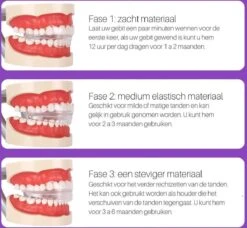 Edoir Rechte Tanden Beugel - Retainer Voor Rechte Tanden - Rechte Tanden Bitje -Verzorgingsproducten 1200x1109 1