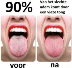 Effectieve Tongschraper (hoge Kwaliteit) - Tongreiniger Koper - Mondverzorging - Persoonlijke Verzorging – Rose Gold - Underdog Tech 5 Effectieve Tongschraper (hoge Kwaliteit) - Tongreiniger Koper - Mondverzorging - Persoonlijke Verzorging – Rose Gold - Underdog Tech -Verzorgingsproducten 1200x1130 7