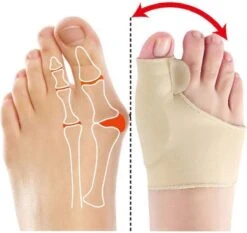 Hallux Valgus - Teenspreider - Teencorrector - Hallux Valgus Grote Teencorrector - Sok 2 Stuks -Verzorgingsproducten 1200x1133