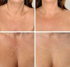 Simia™ Anti Rimpel Beauty Pads - Decolleté Large T Shape Set (2 Stuks) - Herbruikbaar Anti Aging Siliconen Pad Tegen Lijntjes En Slaaprimpels 11 Simia™ Anti Rimpel Beauty Pads - Decolleté Large T Shape Set (2 Stuks) - Herbruikbaar Anti Aging Siliconen Pad Tegen Lijntjes En Slaaprimpels -Verzorgingsproducten 1200x1139 1