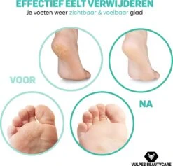 Vulpes BeautyCare® Elektrische Eelt Verwijderaar Pro – Stofzuigfunctie – 3 Snelheden – Inclusief 3 Vijlschijven & Borstel - USB-Oplaadbaar 13 Vulpes BeautyCare® Elektrische Eelt Verwijderaar Pro – Stofzuigfunctie – 3 Snelheden – Inclusief 3 Vijlschijven & Borstel - USB-Oplaadbaar -Verzorgingsproducten 1200x1149