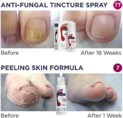 Footlogix Toe Nail Tincture Nagelspray 9 Footlogix Toe Nail Tincture Nagelspray -Verzorgingsproducten 1200x1150 1