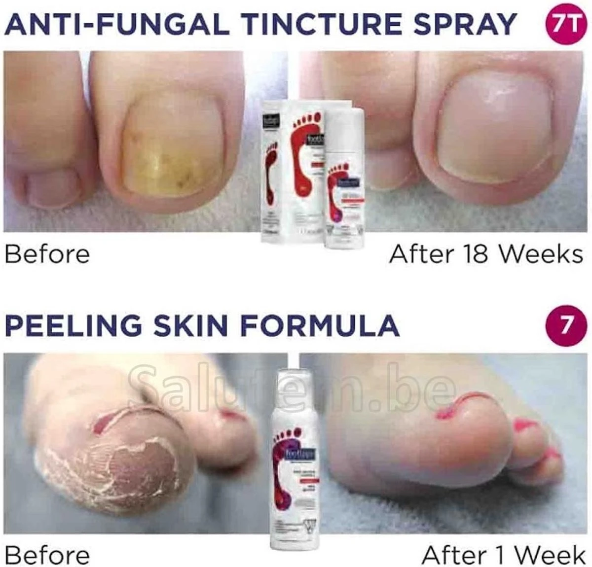 Footlogix Toe Nail Tincture Nagelspray 5 Footlogix Toe Nail Tincture Nagelspray - Afbeelding 3