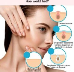 Acne Patches (108x) Met Blackhead Remover Set - Puisten Pleister - Puisten Verwijderaar - 108 Pleisters In 2 Formaten - Mee Eters Verwijderen - Pimple Patch Voor Acneverzorging Met Comedonenlepel Set - Acne Stickers -Verzorgingsproducten 1200x1158 8