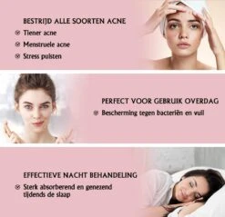 Acne Patches Voor Dag En Nacht - Puisten Verwijderaar - Huidreiniger - 144 Stuks In 2 Formaten - Pukkel Pleister - Pimple Patch Die Onzuiverheden Absorbeert - Acneverzorging -Verzorgingsproducten 1200x1162 12