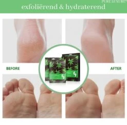 PureLuxure Voetmasker - Voetverzorging - Eeltsokken - Eelt Verwijderaar - Voetenmasker - Peel Off Masker - 1 Paar (2 Stuks) -Verzorgingsproducten 1200x1191 2