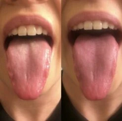 Orabrush Tongreiniger -Verzorgingsproducten 1200x1197 15