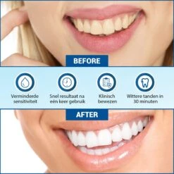 V-Goods Premium Whitening Strips - Tandenbleek Strips - Wittere Tanden - 28x Tandenbleek Strips DIRECT Resultaat - Tandenbleekset - Whitening - Tandenblekers -Verzorgingsproducten 1200x1199 25