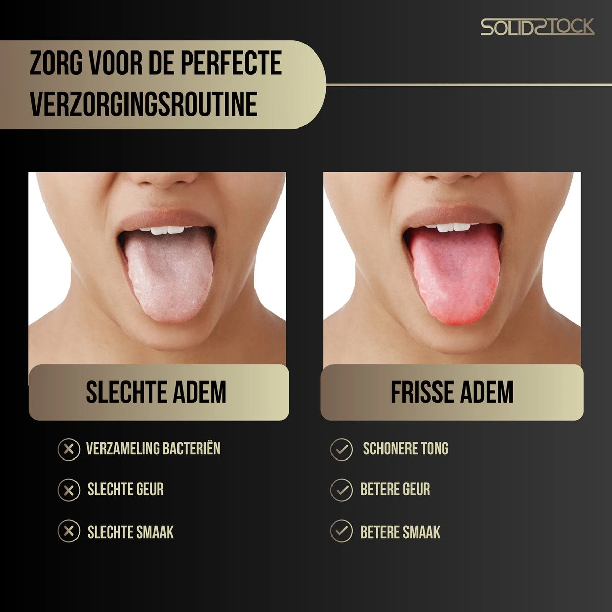 SolidStock Professionele Tongschraper Voor Mondverzorging - 4 Delige Tongreiniger - Ayurveda - RVS 4 SolidStock Professionele Tongschraper Voor Mondverzorging - 4 Delige Tongreiniger - Ayurveda - RVS - Afbeelding 2