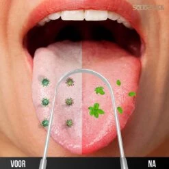 SolidStock Professionele Tongschraper Voor Mondverzorging - 4 Delige Tongreiniger - Ayurveda - RVS 14 SolidStock Professionele Tongschraper Voor Mondverzorging - 4 Delige Tongreiniger - Ayurveda - RVS -Verzorgingsproducten 1200x1200 1465
