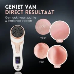 Beeperfect® Elektrische Eeltverwijderaar Met Stofzuigsysteem - Voetvijl - Eeltvijl - IPX7 Waterdicht - Gratis Pedicure Set -Verzorgingsproducten 1200x1200 149