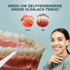 Merkloos Tandsteen Verwijderaar Elektrisch – Tandenborstel Opzetstukken - Tandarts Spiegel - 5 Standen -Wit -Verzorgingsproducten 1200x1200 1728