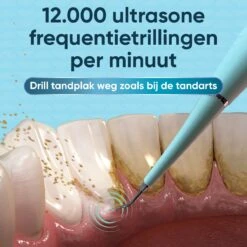Whitee Elektrische Tandsteen Verwijderaar - Tanden Polijsten - Tandarts Tandsteenverwijderaars - Elektrisch Tandplak Verwijderen -Verzorgingsproducten 1200x1200 1747