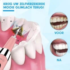 DEN-T® PRO U500 - Elektrische Sonische Tandsteen Verwijderaar - Roze -Verzorgingsproducten 1200x1200 1773