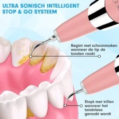 DEN-T® PRO U500 - Elektrische Sonische Tandsteen Verwijderaar - Roze -Verzorgingsproducten 1200x1200 1775