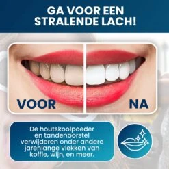 Tandenbleekset - Teeth Whitening - Teeth Whitener - Wittere Tanden - Tanden Bleken - Direct Resultaat - Zelfde Effect Als Whitening Strips -Verzorgingsproducten 1200x1200 1896