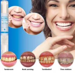 B-care Tanden Bleekpen - Teeth Whitening Pen - Tanden Bleker - Wittere Tanden - Teeth Whitening Strips - Professioneel Resultaat - Tandsteen Verwijderaar - Zonder Peroxide - Tandenbleekset - Tanden Bleken 19 B-care Tanden Bleekpen - Teeth Whitening Pen - Tanden Bleker - Wittere Tanden - Teeth Whitening Strips - Professioneel Resultaat - Tandsteen Verwijderaar - Zonder Peroxide - Tandenbleekset - Tanden Bleken -Verzorgingsproducten 1200x1200 1926