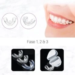 Edoir Rechte Tanden Beugel - Retainer Voor Rechte Tanden - Rechte Tanden Bitje -Verzorgingsproducten 1200x1200 1940