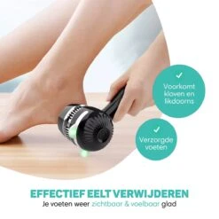 Vulpes BeautyCare® Elektrische Eelt Verwijderaar Pro – Stofzuigfunctie – 3 Snelheden – Inclusief 3 Vijlschijven & Borstel - USB-Oplaadbaar 16 Vulpes BeautyCare® Elektrische Eelt Verwijderaar Pro – Stofzuigfunctie – 3 Snelheden – Inclusief 3 Vijlschijven & Borstel - USB-Oplaadbaar -Verzorgingsproducten 1200x1200 197