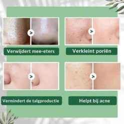 MENGSIQI - Green Mask Stick - Huidverzorging - Gezichtsmasker - Kleimasker - Mee Eters & Acne Verwijderen - Acne Verzorging - Vette Huid - Mee-eter Verwijderaar - Poriën Reiniger -Blackhead - Unisex - Verzachtend -Verkoelend - Dermatologisch Getest -Verzorgingsproducten 1200x1200 2112