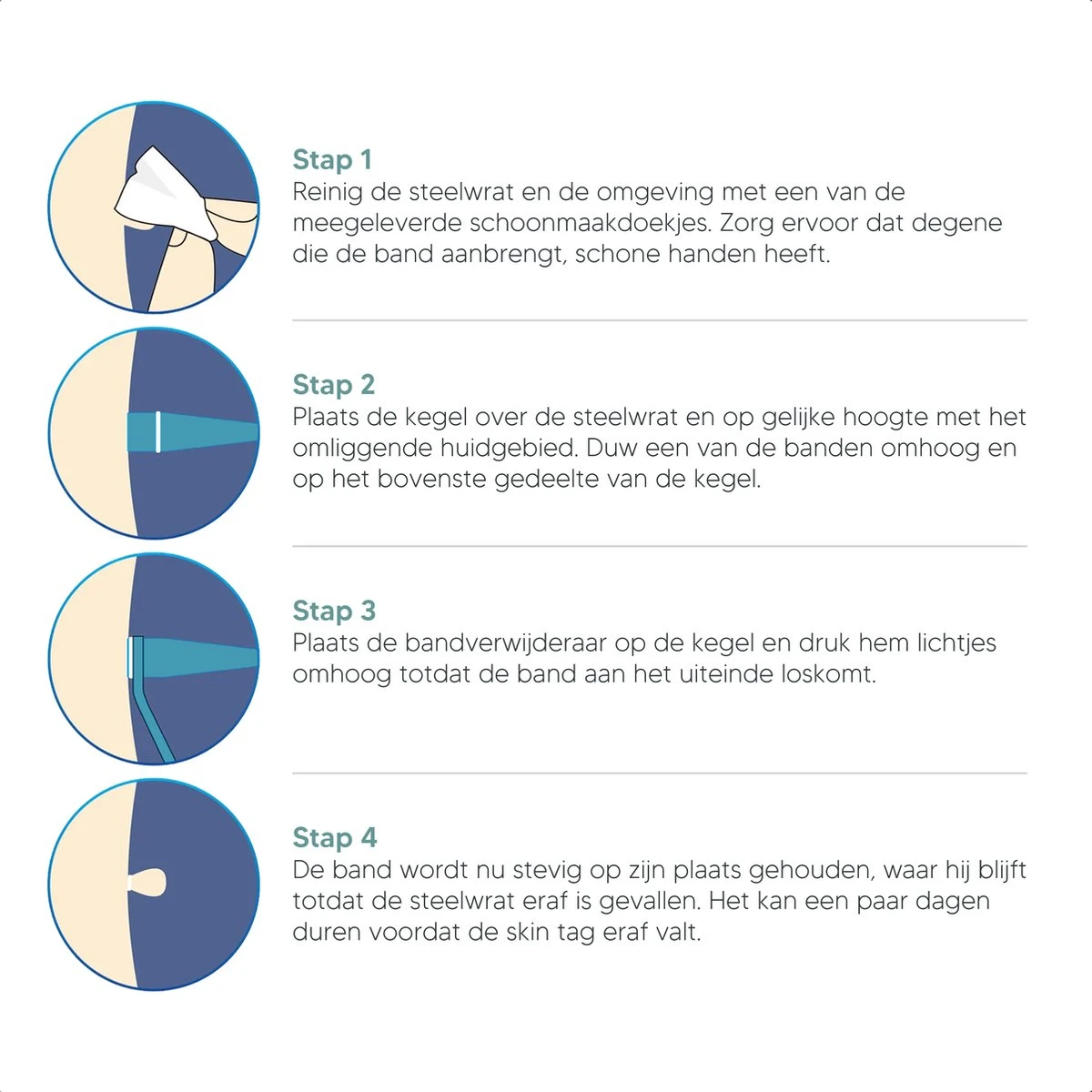 Johannes & Co Steelwratjes Verwijderen Kit - Wrattenverwijderaar – 2x Kegels 8 Johannes & Co Steelwratjes Verwijderen Kit - Wrattenverwijderaar – 2x Kegels - Afbeelding 6