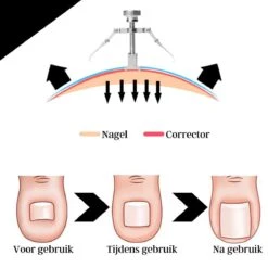 7-delige Pedicure En Manicure Set - Nagelknipper - Pedicureset - Nagelvijl - Nageltang - Kalknagel - Teennagelknipper 15 7-delige Pedicure En Manicure Set - Nagelknipper - Pedicureset - Nagelvijl - Nageltang - Kalknagel - Teennagelknipper -Verzorgingsproducten 1200x1200 365