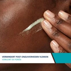 CeraVe Resurfacing Retinol Serum - 30ml - Voor Onzuivere Huid Met Neiging Tot Acne 16 CeraVe Resurfacing Retinol Serum - 30ml - Voor Onzuivere Huid Met Neiging Tot Acne -Verzorgingsproducten 1200x1200 498