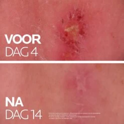 La Roche-Posay Cicaplast Balsem B5+ - 40ml - Voor Gevoelige Huid - Helpt De Huid Herstellen -Verzorgingsproducten 1200x1200 635