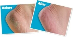 O'Keeffe's - Voetencreme - Voor Gezonde Voeten - Potje 96 Gram 18 O'Keeffe's - Voetencreme - Voor Gezonde Voeten - Potje 96 Gram -Verzorgingsproducten 1200x622