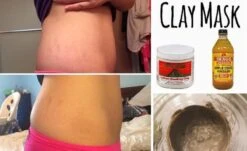 Aztec Secret Indian Healing Clay Gezichtsmasker - 454 G - 100% Natuurlijke Betonine Clay - New Formula -Verzorgingsproducten 1200x736 2