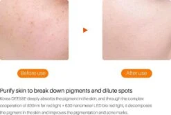 JTEX® - Professioneel LED Masker - Gezichtsmasker - Face Mask - Lichttherapie - 7 Soorten Behandelingen - Anti Rimpel - Anti Acne Huidverzorging - Skin Cleaner - Masker - Anti Aging Mask - Gezichtsbehandeling - New Generation - LED Masker -Verzorgingsproducten 1200x808 5