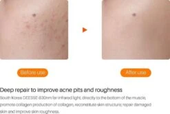 JTEX® - Professioneel LED Masker - Gezichtsmasker - Face Mask - Lichttherapie - 7 Soorten Behandelingen - Anti Rimpel - Anti Acne Huidverzorging - Skin Cleaner - Masker - Anti Aging Mask - Gezichtsbehandeling - New Generation - LED Masker -Verzorgingsproducten 1200x808 6