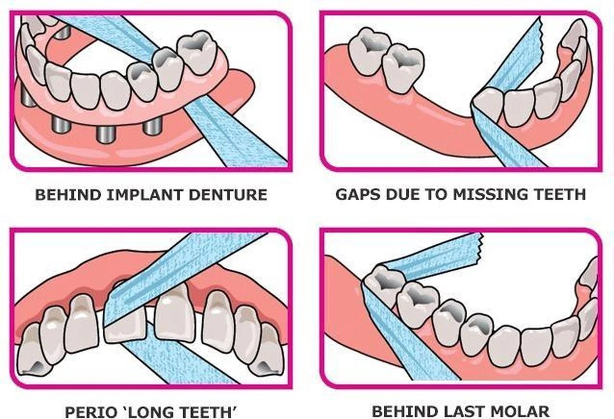 IDontix X-Ribbon - 12mtr 4 IDontix X-Ribbon - 12mtr - Afbeelding 2