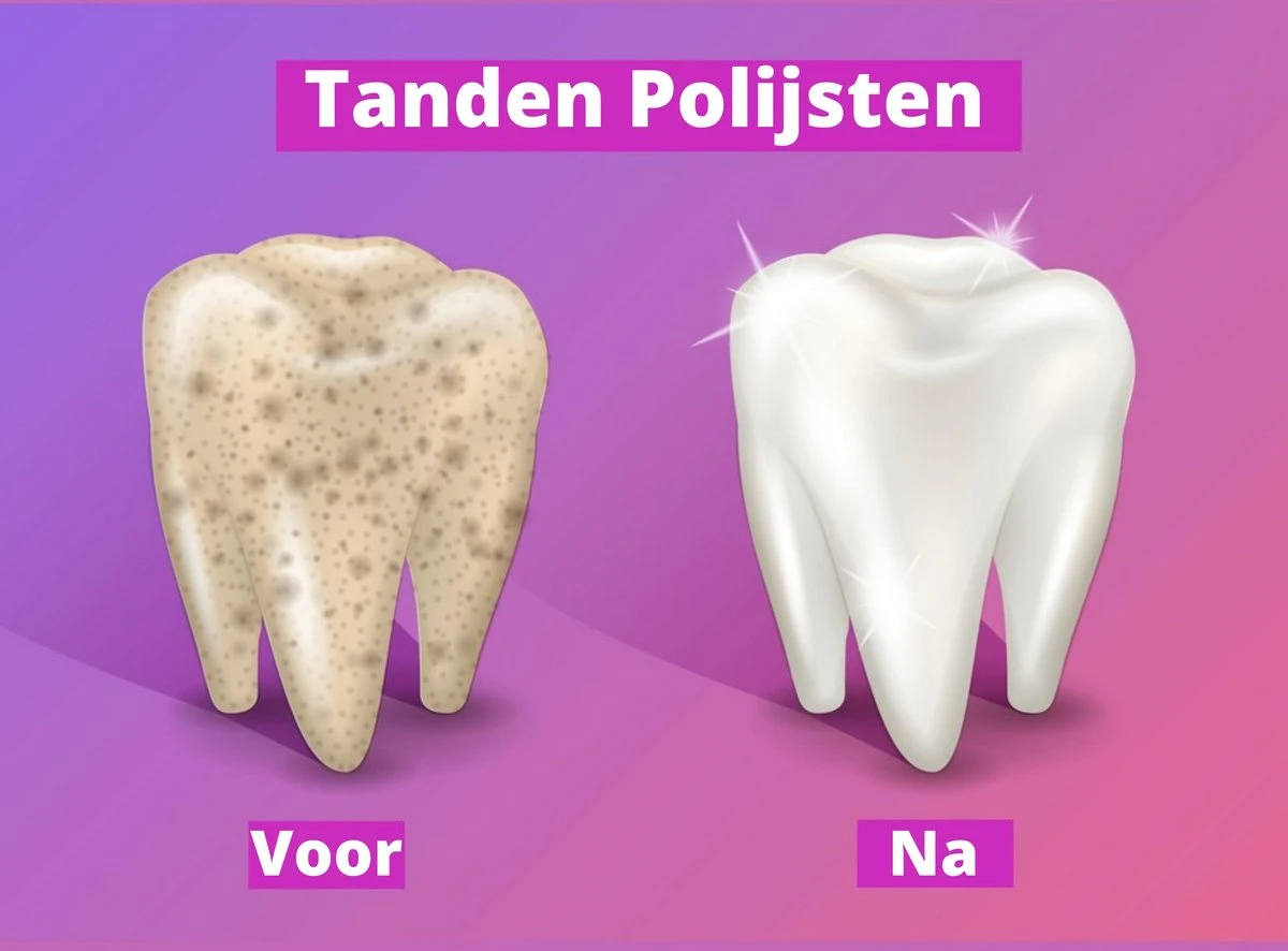 Merkloos HQ Tooth Polisher - Tanden Polijsten - Wittere Tanden - Tandsteen Tandplak Verwijderaar - Elektrisch 7 Merkloos HQ Tooth Polisher - Tanden Polijsten - Wittere Tanden - Tandsteen Tandplak Verwijderaar - Elektrisch - Afbeelding 5