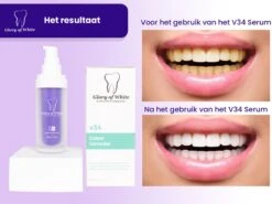 Glory Of White V34 Serum - Kleurcorrector - Witte Tanden - Tandpasta - Tanden Reinigen - Teeth Whitening - 30ML 17 Glory Of White V34 Serum - Kleurcorrector - Witte Tanden - Tandpasta - Tanden Reinigen - Teeth Whitening - 30ML -Verzorgingsproducten 1200x899 15